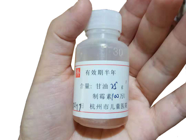 寶寶嘴里長(zhǎng)了白色斑點(diǎn)，很可能是鵝口瘡